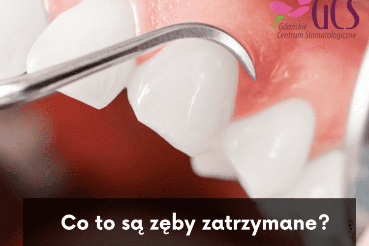 zęby