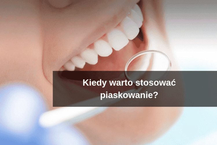 przegląd zębów