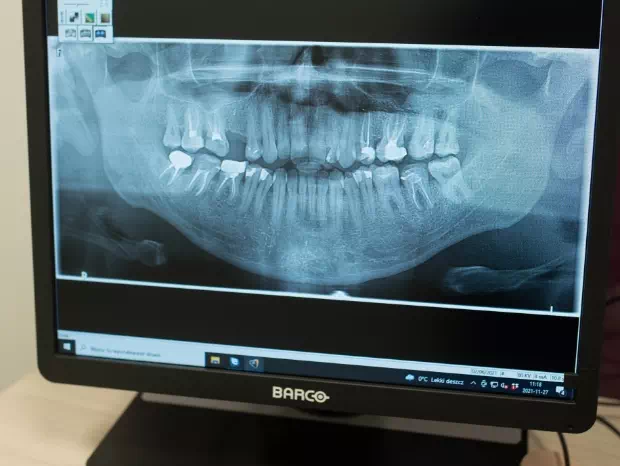 zdjęcie radiologiczne zębów